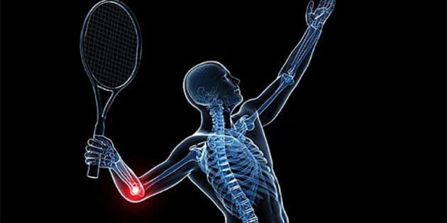 Tennis Elbow- Here’s How We Can Help!