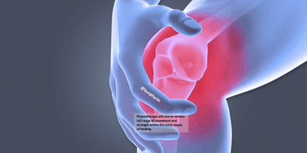 IS YOUR MENISCUS CAUSING YOUR KNEE PAIN?