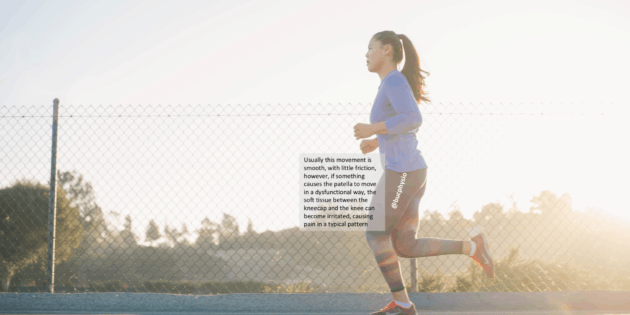 WHAT IS RUNNER’S KNEE? (Also known as PFJ syndrome)